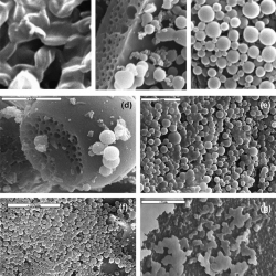 Desarrollan unas micro cápsulas que hacen llegar medicamentos vía oral específicamente al colon Consiguen que el medicamento se libere en el colon, y no en el estomago 