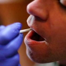 Análisis de sangre y saliva ayudan a predecir la recurrencia de cánceres orales vinculados al VPH