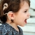 Prueban implante para ayudar a niños con sordera