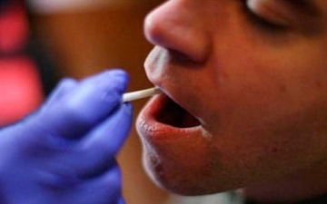 Análisis de sangre y saliva ayudan a predecir la recurrencia de cánceres orales vinculados al VPH