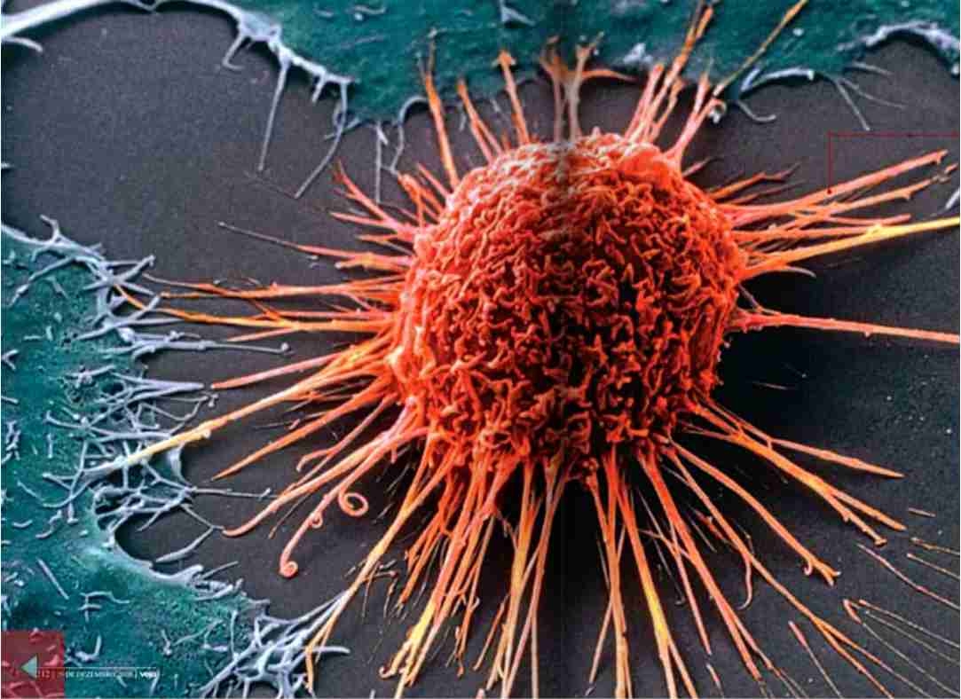 Científicos del IBEC describen cómo las células cancerígenas del tumor mamario se adhieren al Científicos del IBEC describen cómo las células cancerígenas del tumor mamario se adhieren al